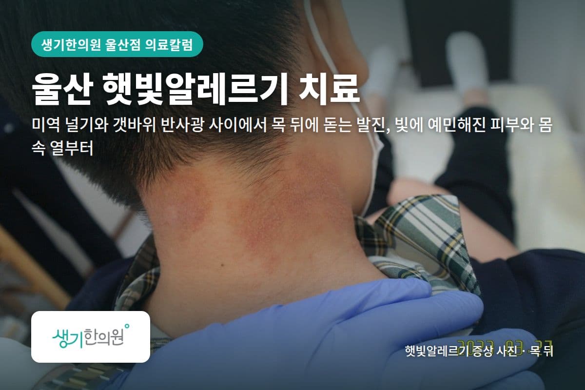 목 뒤 햇빛알레르기 증상 사진과 문구 「울산 햇빛알레르기 치료, 미역 널기와 갯바위 반사광 사이에서 목 뒤에 돋는 발진, 빛에 예민해진 피부와 몸속 열부터 · 생기한의원 울산점」