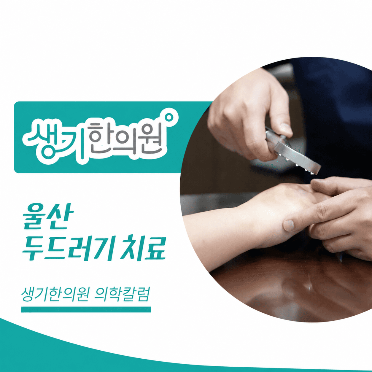 확대경으로 손등 피부를 살펴보는 진료 사진과 울산 두드러기 치료 문구가 있는 생기한의원 의학칼럼 썸네일